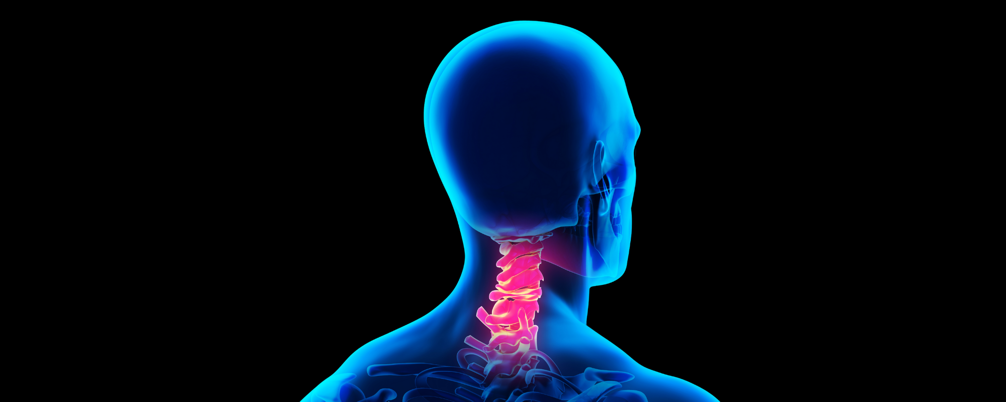 Boyun Fıtığı Nedir? Boyun Fıtığı Belirtileri, Nedenleri ve Tedavisi