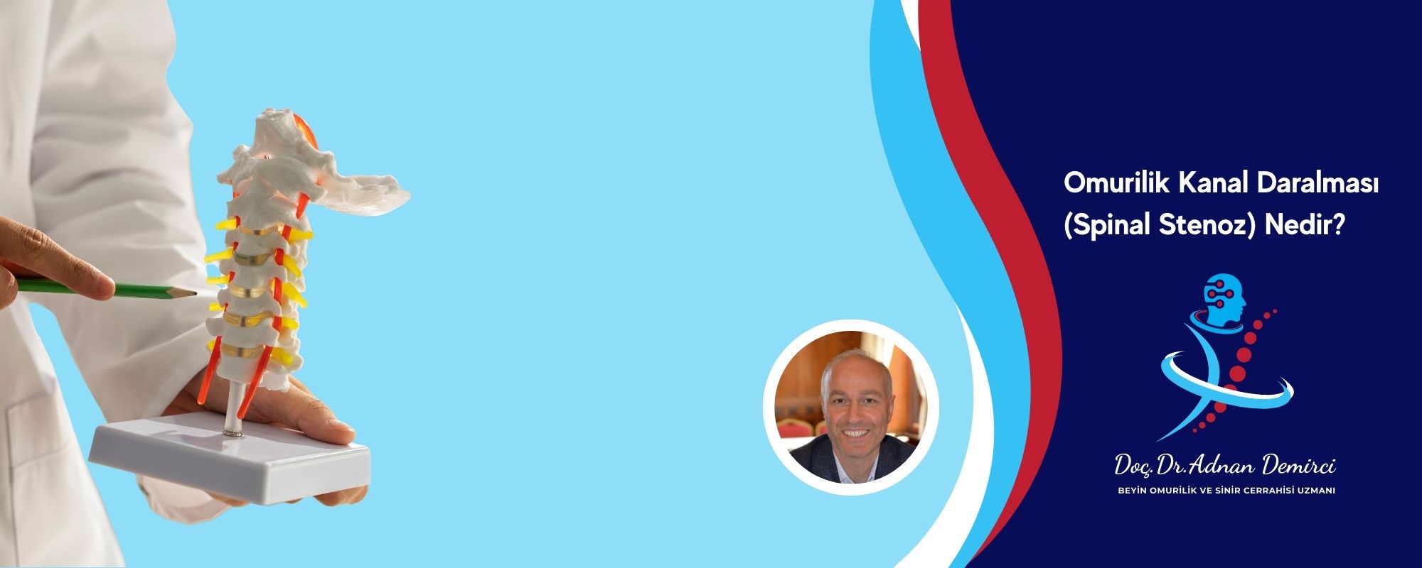 Omurilik Kanal Daralması (Spinal Stenoz) Nedir?