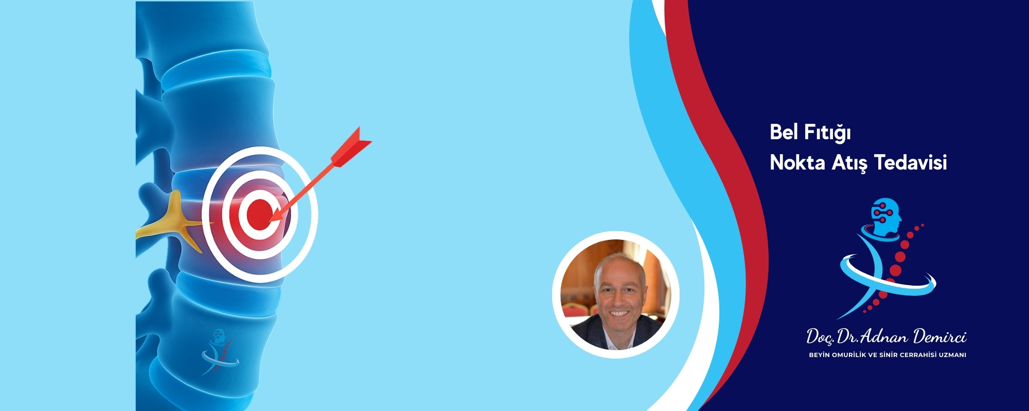 Bel fıtığı nokta atış tedavisi - ameliyatsız tedavi yöntemi